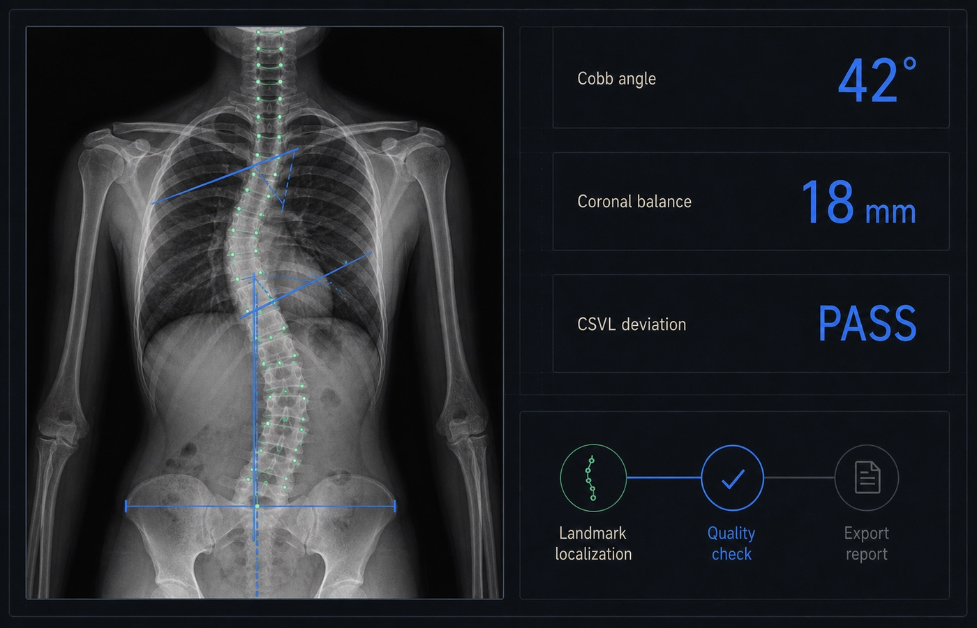 AI-assisted Cobb angle and coronal alignment measurement interface